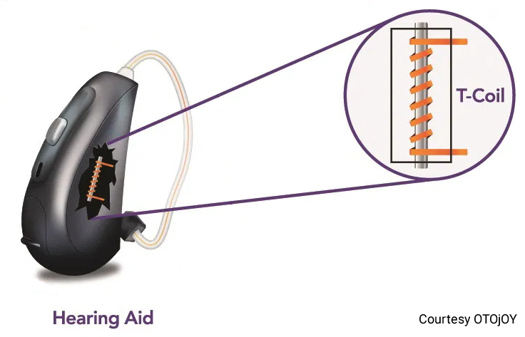 graphic of a telecoil in a hearing aid