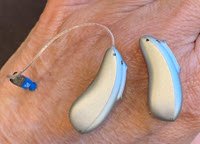 2 hearing aids, one with a telecoil and one without. They are relatively the same size.