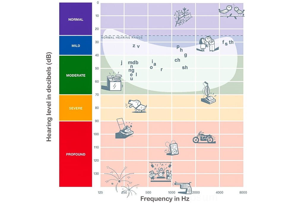 Audiogram showing frequency and hearing level